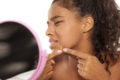 Accutane (Isotretinoin): Acne in Individuals with Dark Skin