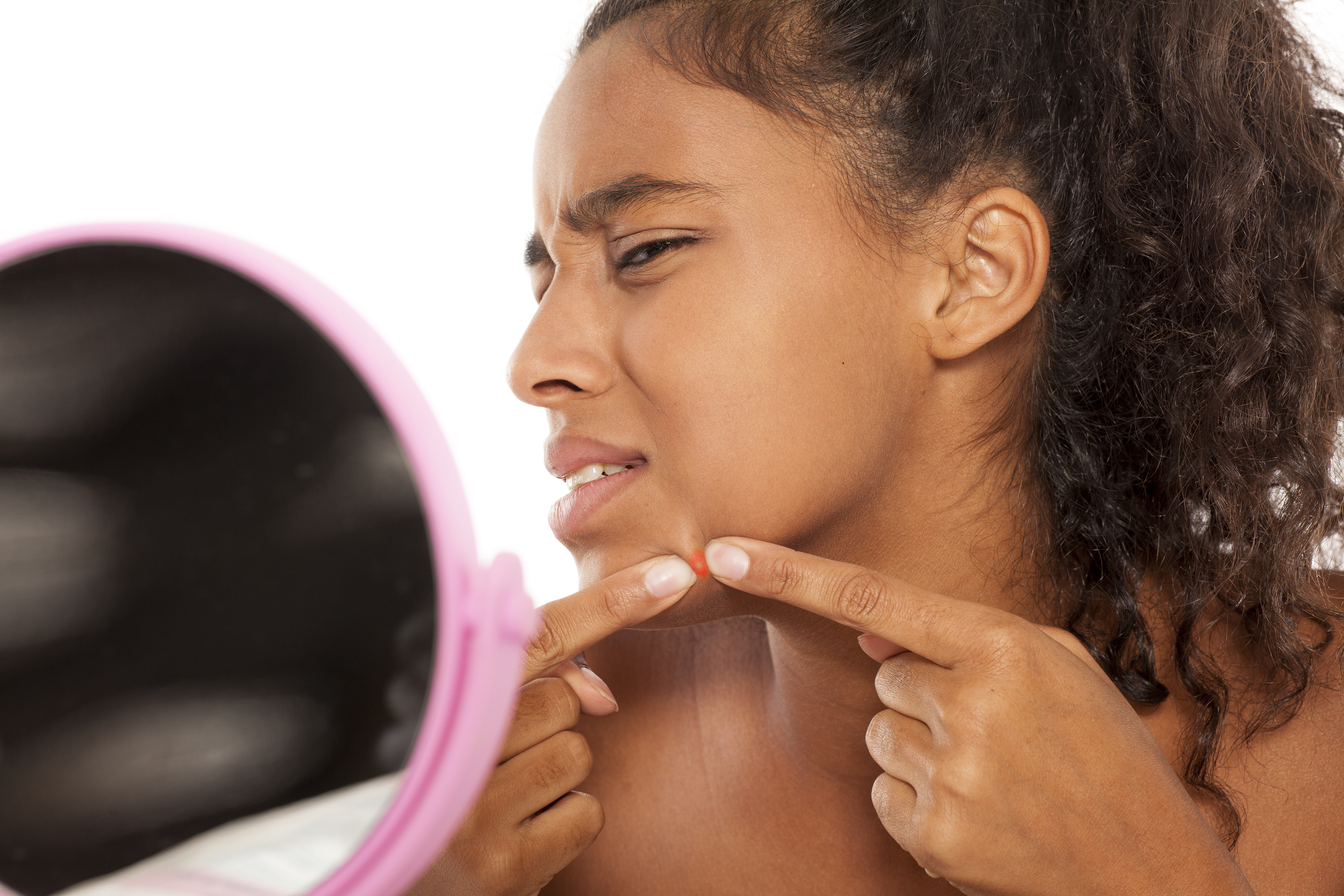 young beautiful black woman squeezing pimples on her face